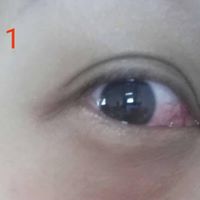 Bio-Aquacel Eye Safe